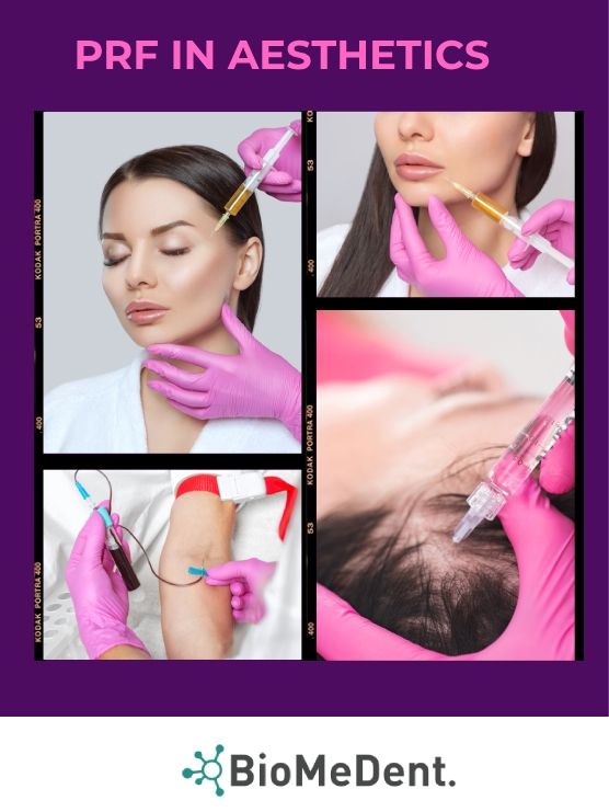 Hands on PRF July 2022