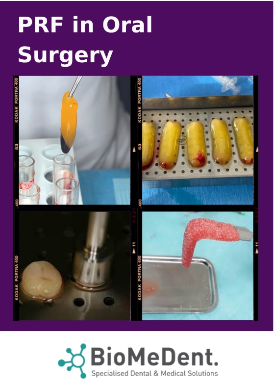 Hands on PRF July 2022