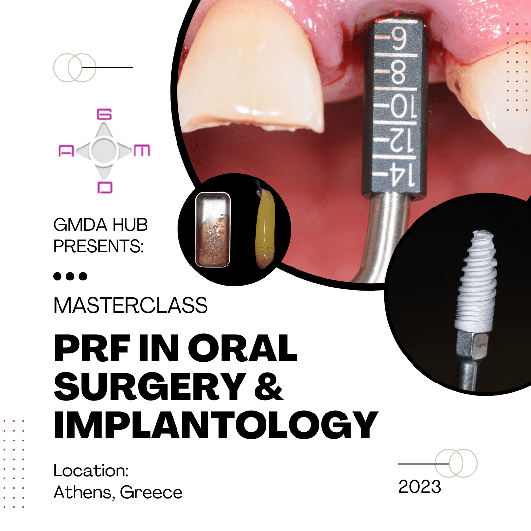 Hands on PRF July 2022